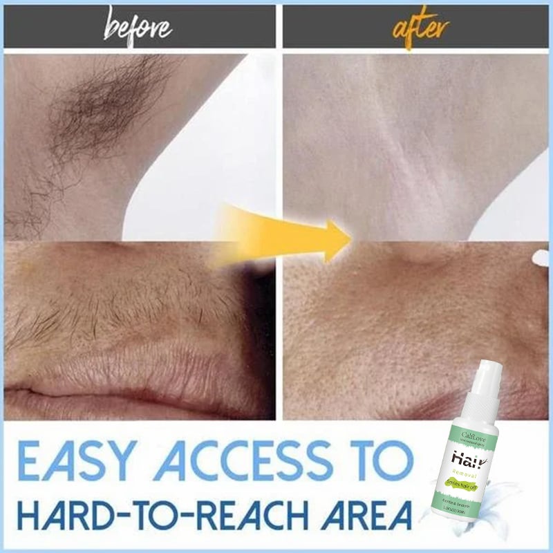 Semi-permanent Hair Removal